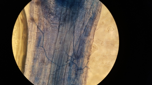 Dyed plant roots colonized by Arbuscular Mycorrhizal Fungi, 2019